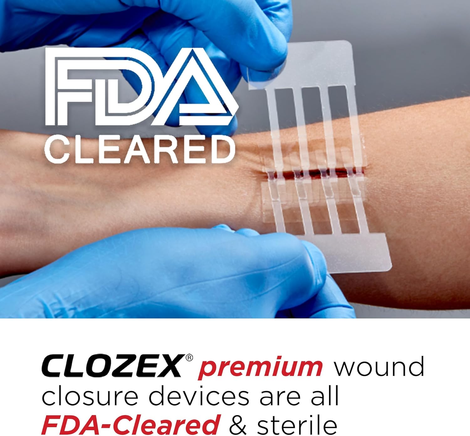 Clozex Emergency Laceration Closures