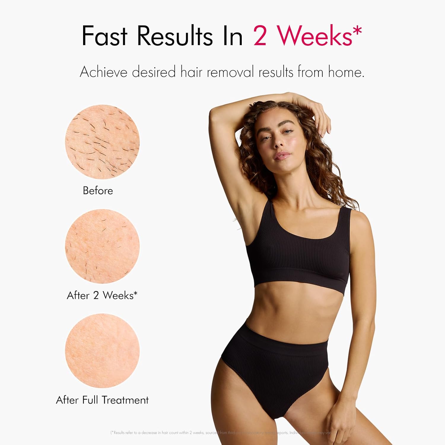 Laser Hair Removal