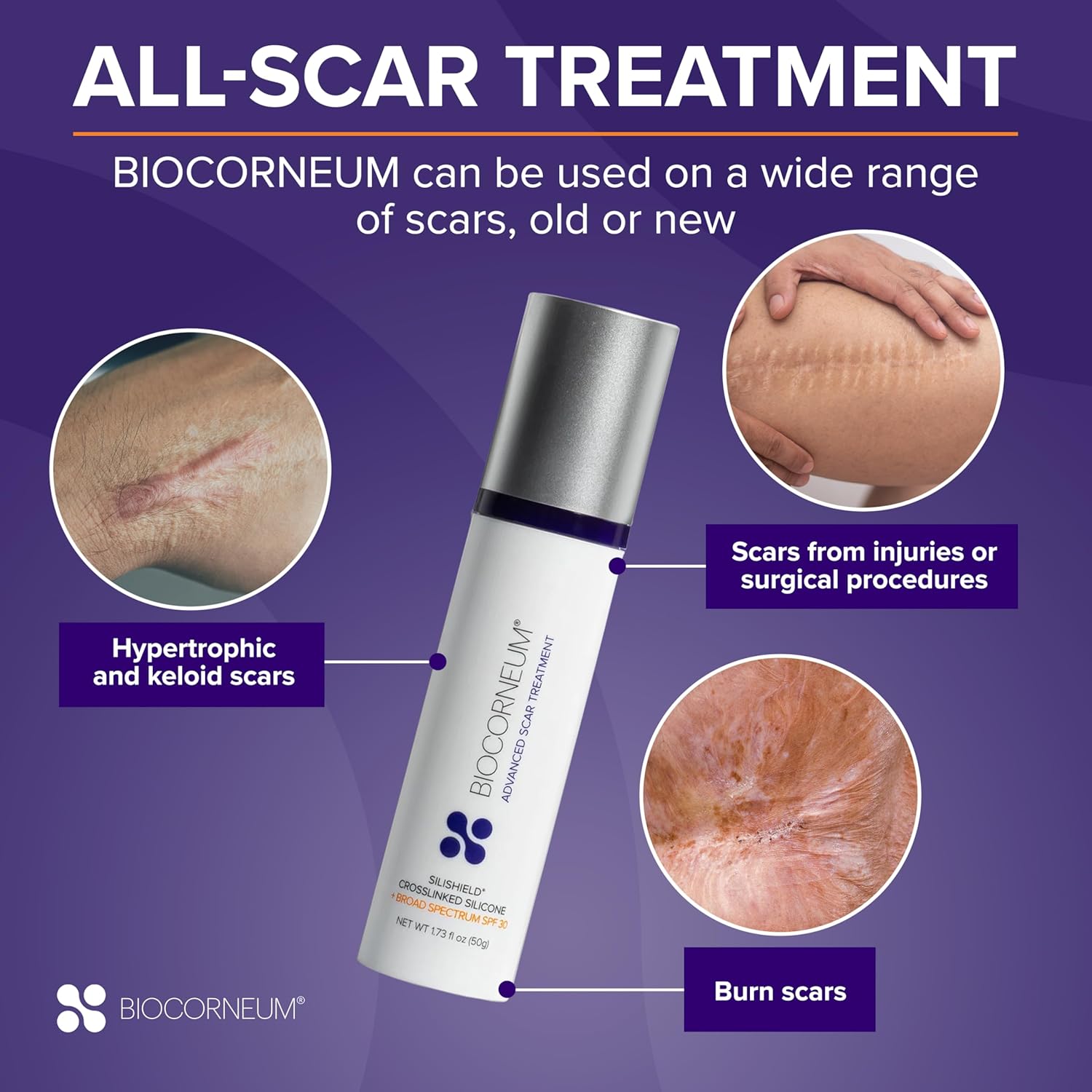 Adv Scar Treatment